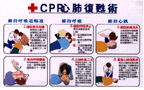 CPR